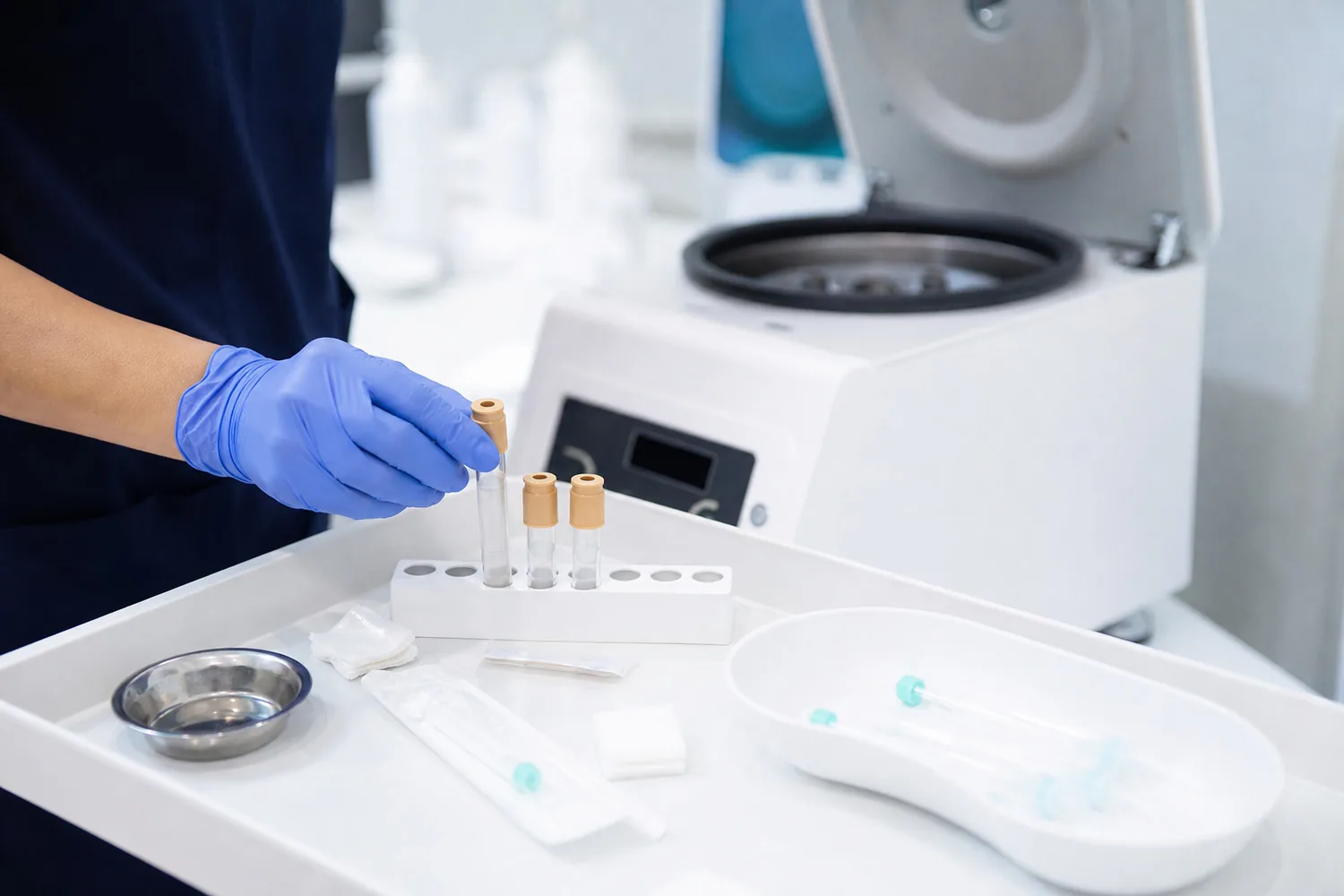 PRP treatment clinical setup